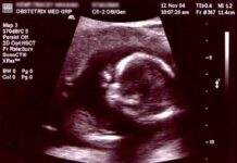Parlament Liechtensteinu za liberalizacją aborcji, ale książę zapowiada weto Archiwalny wydruk USG z 2004 r.: widoczna główka i sylwetka dziecka w łonie matki. Zdjęcie ilustracyjne, nie dokumentuje wydarzeń w Liechtensteinie.
